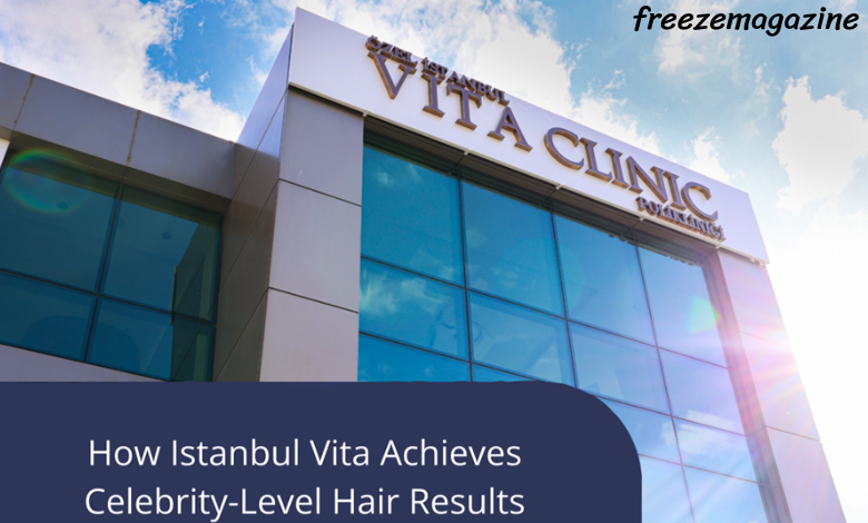 female and male celebrities with hair transplants