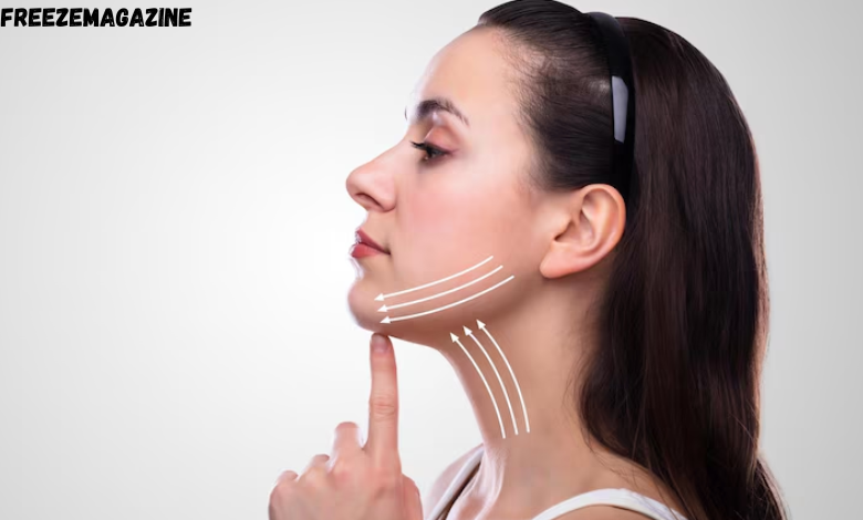 deep plane facelift in UK