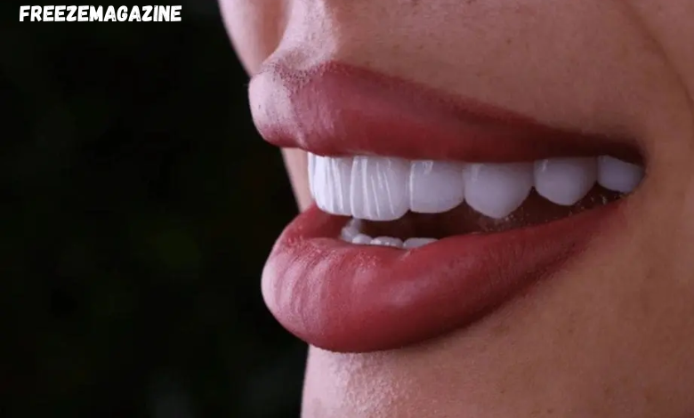 Dentakay Dental Clinics,