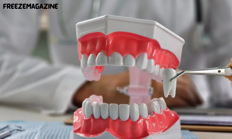 wisdom tooth extraction cost in Singapore